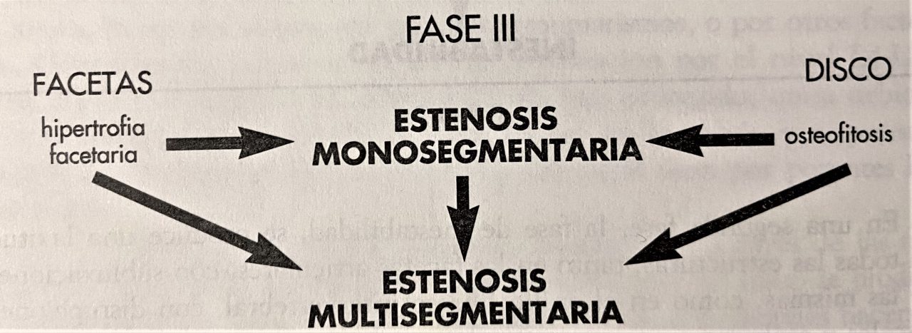 Hipertrofia facetaria lumbar l5-s1