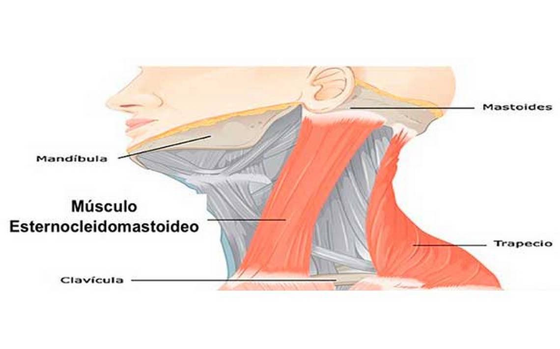 Contractura cervical bulto cuello